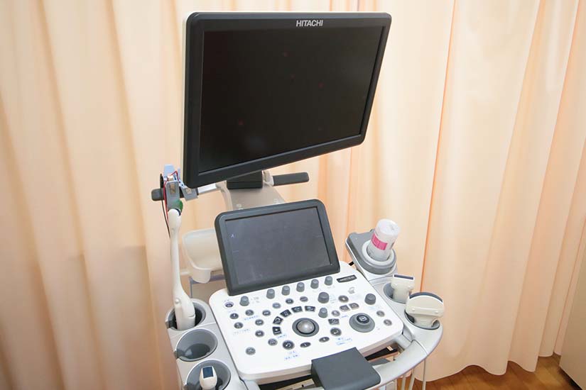 超音波診断装置